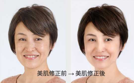 美肌修正